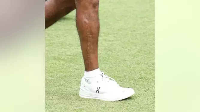 Tiger Woods Shows Off Gnarly Leg Scar For First Time Since 2021 Car Crash