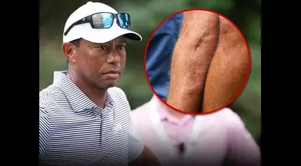 Tiger Woods Shows Off Gnarly Leg Scars Three Years After Car Crash