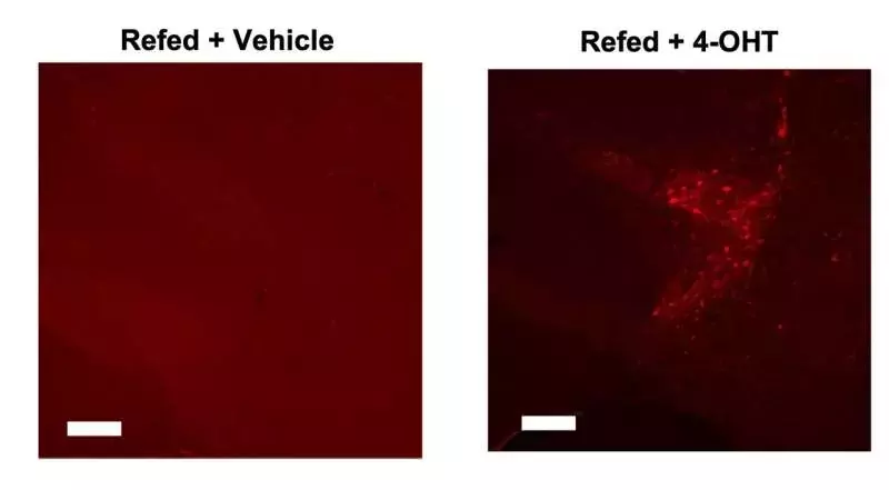 Scientists pinpoint brain cells that delay first bite of food