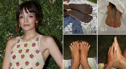 Lily Allen's Lucrative Leap: From Spotify Streams to OnlyFans Feet Pics